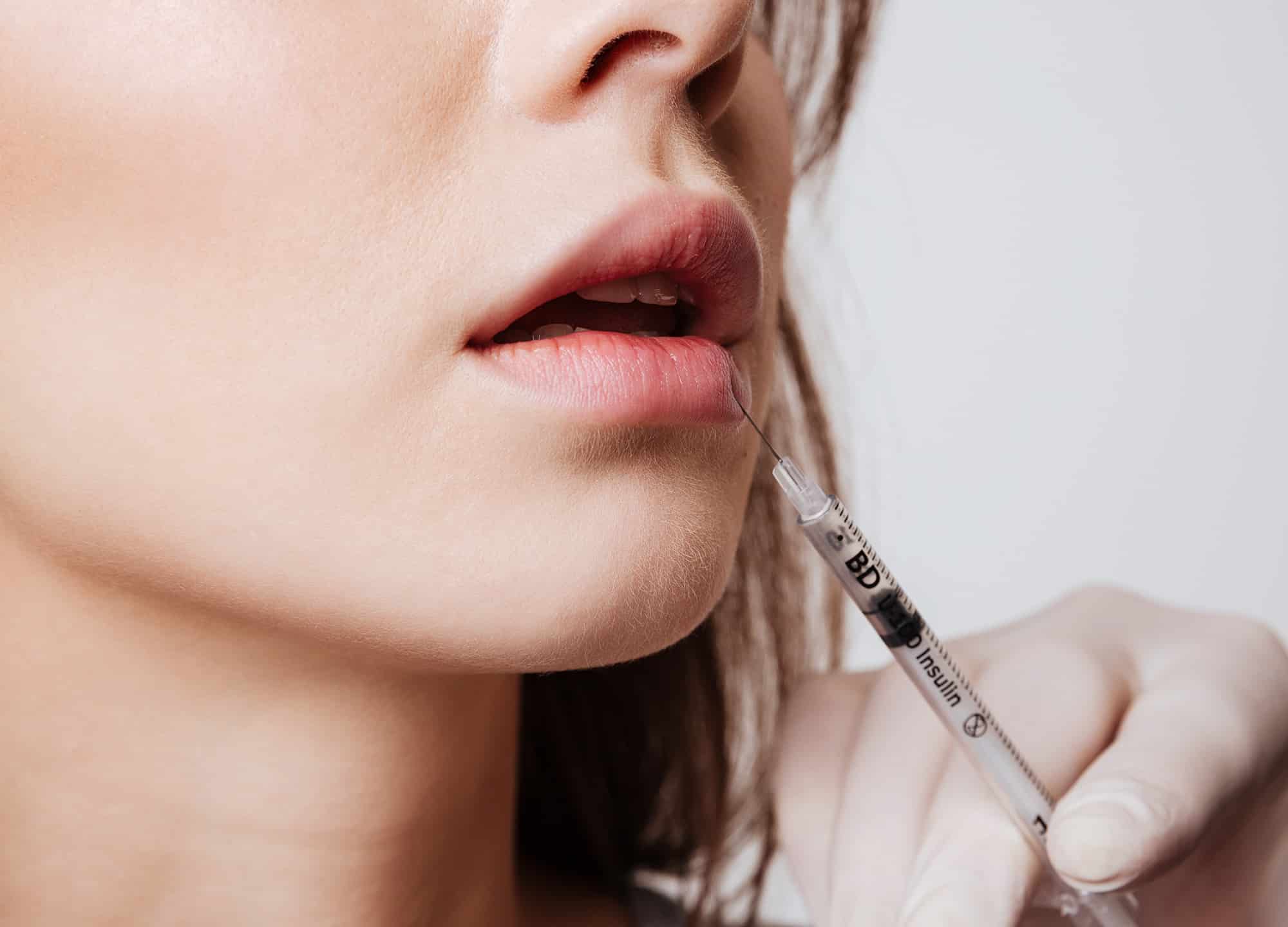 reduce swelling after lip filler